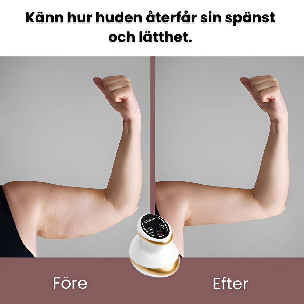 CelluFree - Anti-cellulit massage!
