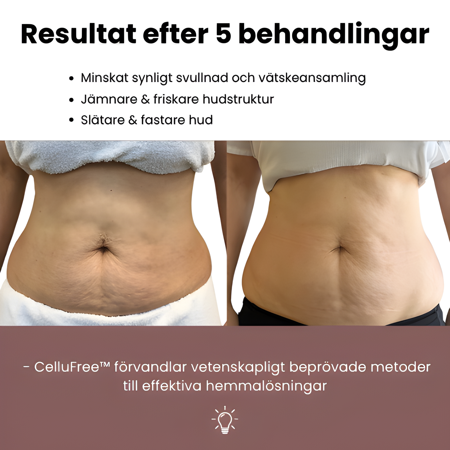 CelluFree - Anti-cellulit massage!