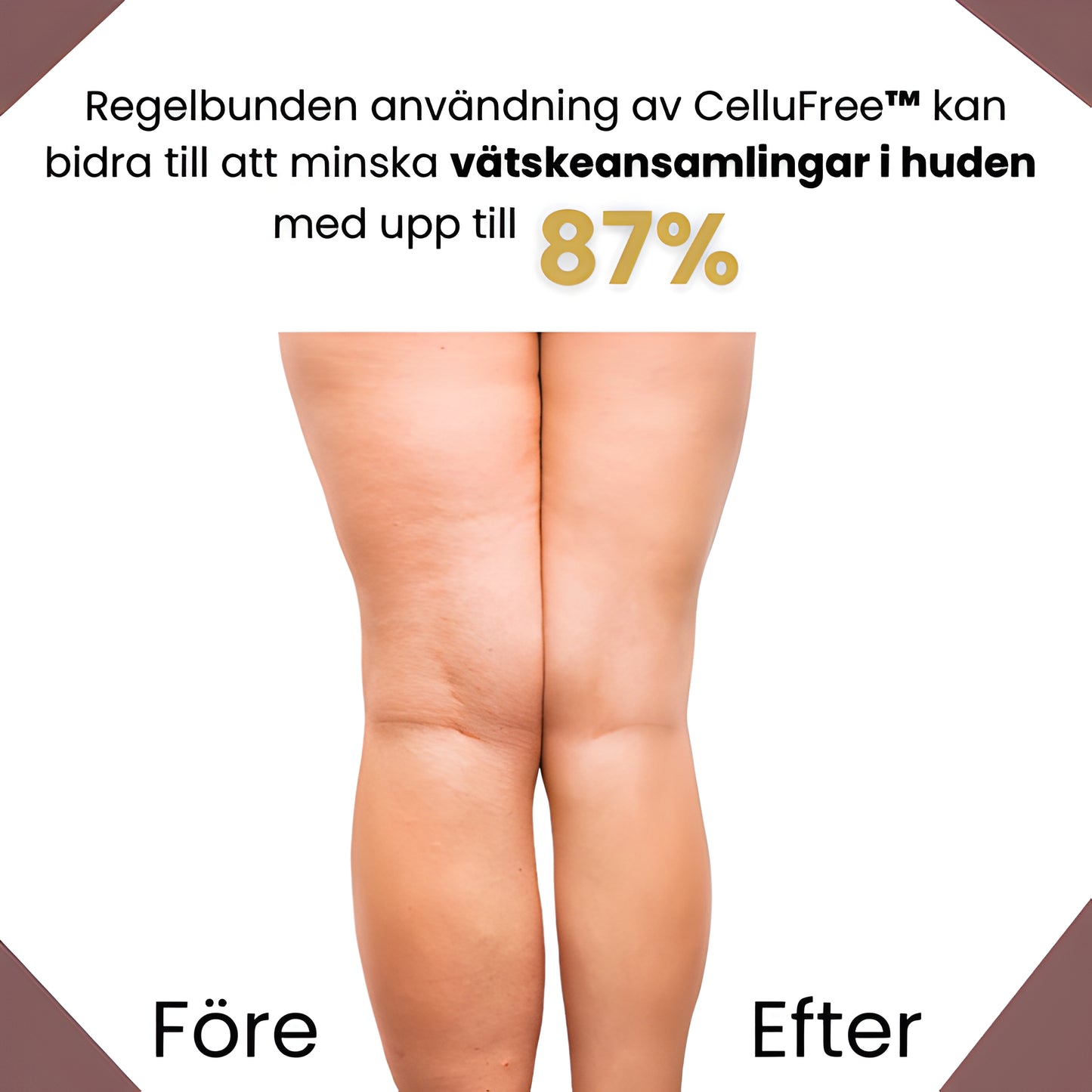 CelluFree - Anti-cellulit massage!